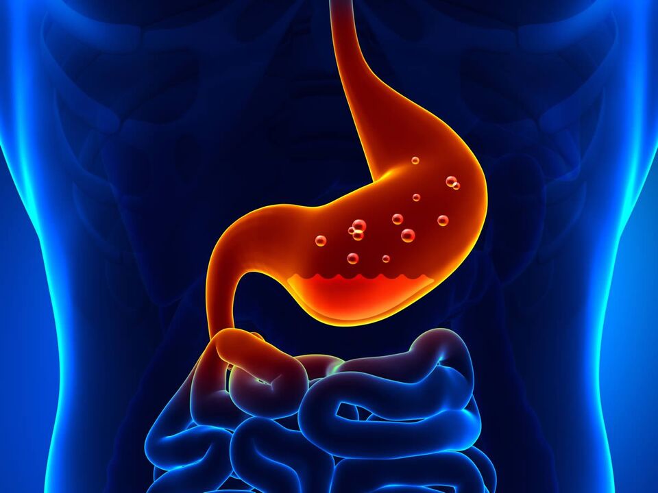 gastric ulcer disease